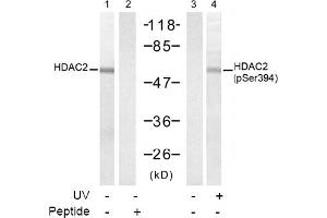 Image no. 1 for anti-Histone Deacetylase 2 (HDAC2) (pSer394) antibody (ABIN319237) (HDAC2 抗体  (pSer394))