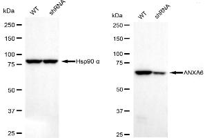 Western blotting analysis using annexin A6 antibody (ABIN7797624). (Recombinant ANXA6 抗体)