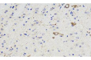 Immunohistochemistry analysis of paraffin-embedded Mouse brain using NOS1 Polyclonal Antibody at dilution of 1:300. (NOS1 抗体)