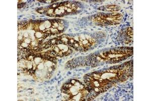 IHC-F: beta Catenin antibody testing of rat intestine tissue (beta Catenin 抗体  (AA 764-781))