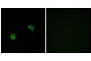 Immunofluorescence analysis of A549 cells, using GPR116 antibody. (G Protein-Coupled Receptor 116 抗体  (C-Term))