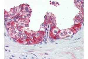 Immunohistochemistry (Paraffin-embedded Sections) (IHC (p)) image for anti-Heat Shock Protein 90kDa alpha (Cytosolic), Class B Member 1 (HSP90AB1) (AA 250-325) antibody (ABIN615278)
