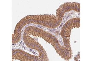 Immunohistochemistry (IHC) image for anti-Catenin (Cadherin-Associated Protein), alpha 1, 102kDa (CTNNA1) (C-Term) antibody (ABIN6260492)