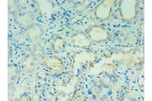 Immunohistochemistry of paraffin-embedded human kidney tissue using ABIN7144131 at dilution of 1:100 (AGT 抗体  (AA 35-285))
