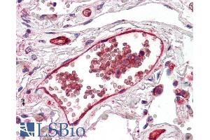 ABIN185480 (5µg/ml) staining of paraffin embedded Human Lung. (DARC 抗体  (N-Term))