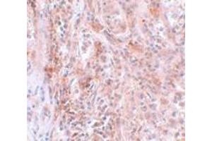 Immunohistochemistry (IHC) image for anti-Breast Carcinoma Amplified Sequence 2 (BCAS2) (C-Term) antibody (ABIN1030285) (BCAS2 抗体  (C-Term))
