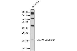 Western blot analysis of extracts of Mouse liver, using V/V/Cellubrevin Rabbit mAb (ABIN7271314) at 1:1000 dilution. (VAMP3 抗体)