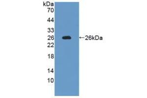 Western blot analysis of recombinant Rat IL12A. (IL12A 抗体  (AA 23-215))