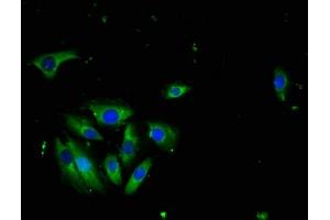 Immunofluorescence staining of A549 cells with ABIN7173786 at 1:100, counter-stained with DAPI. (LTA 抗体  (AA 39-281))