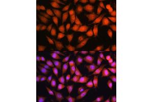 Immunofluorescence (IF) image for anti-OTU Domain, Ubiquitin Aldehyde Binding 1 (OTUB1) (AA 1-220) antibody (ABIN6145086)