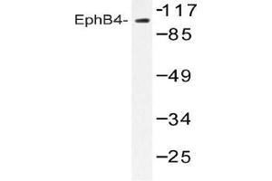 Western blot analysis of EphB4 Antibody in extracts from Jurkat cells. (EPH Receptor B4 抗体)
