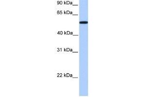WB Suggested Anti-UGT2A3 Antibody Titration:  0. (UGT2A3 抗体  (Middle Region))