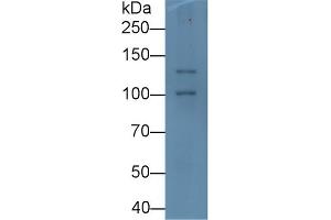 Detection of PIIINP in Rat Pancreas lysate using Monoclonal Antibody to Procollagen III N-Terminal Propeptide (PIIINP) (PIIINP 抗体)