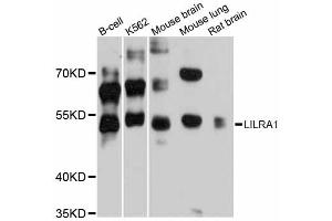 Western blot analysis of extracts of various cell lines, using LILRA1 antibody (ABIN6293167) at 1:3000 dilution. (LILRA1 抗体)