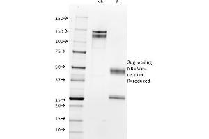 SDS-PAGE Analysis Purified with Nucleolin Monoclonal Antibody (364-5). (Nucleolin 抗体)