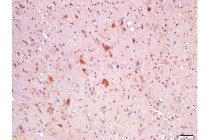 Immunohistochemistry (IHC) image for anti-Wingless-Type MMTV Integration Site Family, Member 8A (WNT8A) (AA 201-300) antibody (ABIN762851)