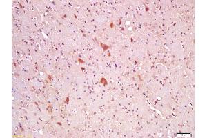 Formalin-fixed and paraffin embedded rat brain labeled with Anti-Wnt8A Polyclonal Antibody, Unconjugated (ABIN762851) at 1:200 followed by conjugation to the secondary antibody and DAB staining (WNT8A 抗体  (AA 201-300))