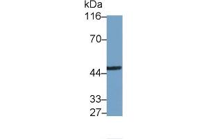Detection of IRAK4 in Rat Cerebrum lysate using Polyclonal Antibody to Interleukin 1 Receptor Associated Kinase 4 (IRAK4) (IRAK4 抗体  (AA 189-427))