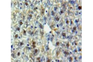 Used in DAB staining on fromalin fixed paraffin-embedded Liver tissue (HSPA9 抗体  (AA 65-311))