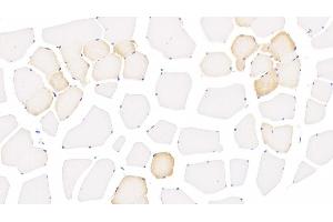 Detection of ALOX15 in Human Skeletal muscle Tissue using Monoclonal Antibody to Arachidonate-15-Lipoxygenase (ALOX15) (ALOX15 抗体  (AA 170-312))