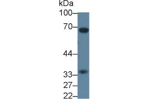 Western blot analysis of Rat Liver lysate, using Rat CASP7 Antibody (3 µg/ml) and HRP-conjugated Goat Anti-Rabbit antibody ( (Caspase 7 抗体  (AA 1-250))