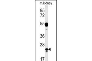 LYSMD1 Antibody (C-term) (ABIN651931 and ABIN2840459) western blot analysis in mouse kidney tissue lysates (15 μg/lane). (LYSMD1 抗体  (C-Term))
