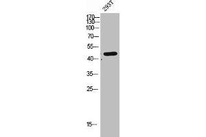 Western Blot analysis of 293T cells using CLN5 Polyclonal Antibody (CLN5 抗体  (Internal Region))