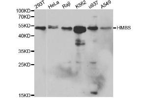 Western blot analysis of extracts of various cell lines, using HMBS antibody. (HMBS 抗体  (AA 1-361))