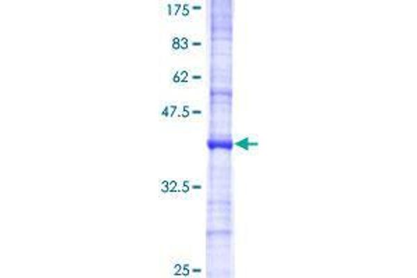 UBE3B Protein (AA 118-225) (GST tag)