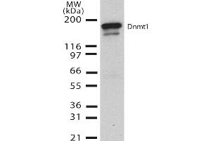 Western Blotting (WB) image for anti-DNA (Cytosine-5)-Methyltransferase 1 (DNMT1) (AA 637-650) antibody (ABIN361726)