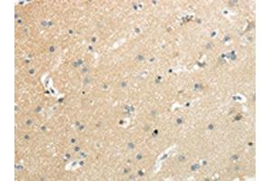 The image on the left is immunohistochemistry of paraffin-embedded Human brain tissue using ABIN7192521(SLC7A11 Antibody) at dilution 1/35, on the right is treated with synthetic peptide. (SLC7A11 抗体)