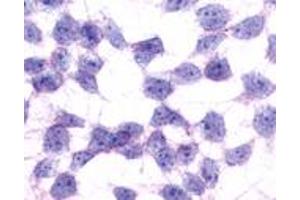 Anti-GPR17 antibody immunocytochemistry (ICC) staining of untransfected HEK293 human embryonic kidney cells. (GPR17 抗体  (N-Term))