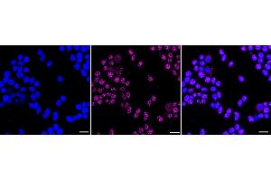Immunocytochemical staining of HeLa cells with MOV10 antibody (ABIN7799485), 1:1,000). (Recombinant Mov10 RISC Complex RNA Helicase (MOV10) 抗体)
