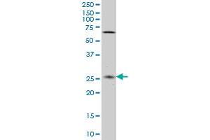 CNO monoclonal antibody (M02), clone 6C3 Western Blot analysis of CNO expression in HeLa .