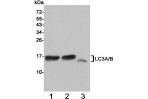 Western blot testing of 1) rat cerebral cortex, 2) rat brain and 3) human HeLa cell  lysates using LC3A/B antibody at 1:1000. (LC3A / LC3B 抗体)
