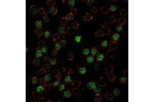 Immunofluorescence (IF) image for anti-Spleen Focus Forming Virus (SFFV) Proviral Integration Oncogene Spi1 (SPI1) (AA 16-170) antibody (ABIN6940631)