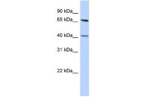 Western Blotting (WB) image for anti-Retinoblastoma Binding Protein 5 (RBBP5) antibody (ABIN2458075) (RBBP5 抗体)