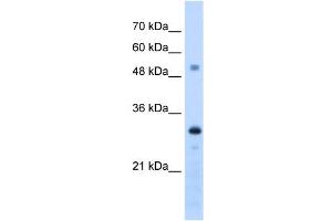 PSME3 antibody used at 1. (PSME3 抗体  (C-Term))