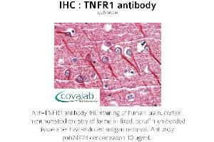 Image no. 1 for anti-Tumor Necrosis Factor Receptor Superfamily, Member 1A (TNFRSF1A) antibody (ABIN1740186) (TNFRSF1A 抗体)