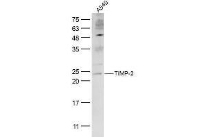 A549 lysates probed with TIMP-2 Polyclonal Antibody, Unconjugated  at 1:300 dilution and 4˚C overnight incubation. (TIMP2 抗体  (AA 51-150))