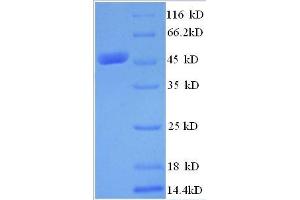 MYST Histone Acetyltransferase 2 (MYST2) (AA 1-214), (partial) protein (GST tag) (MYST2 Protein (AA 1-214, partial) (GST tag))