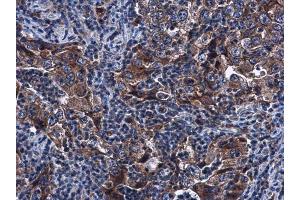 Immunohistochemistry (IHC) image for anti-Sirtuin 3 (SIRT3) (C-Term) antibody (ABIN2856305)
