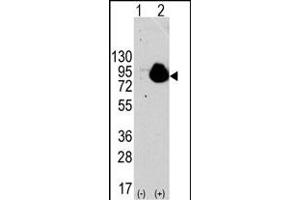 Western blot analysis of RPS6KA1 (arrow) using rabbit polyclonal RPS6KA1 Antibody . (RPS6KA1 抗体  (AA 710-735))