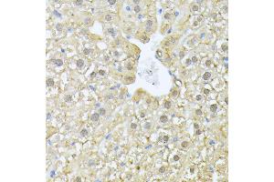 Immunohistochemistry of paraffin-embedded mouse liver using PSM antibody (ABIN1682332, ABIN3018467, ABIN3018468 and ABIN6220474) at dilution of 1:100 (40x lens). (PSMA7 抗体  (AA 1-248))