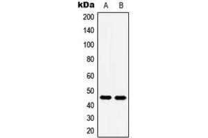 Western blot analysis of 5-HT1A expression in Saos2 (A), Jurkat (B) whole cell lysates. (Serotonin Receptor 1A 抗体  (C-Term))