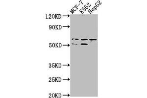 Western Blot Positive WB detected in: MCF-7 whole cell lysate, K562 whole cell lysate, HepG2 whole cell lysate All lanes: USP17L3 antibody at 1:1000 Secondary Goat polyclonal to rabbit IgG at 1/50000 dilution Predicted band size: 60 kDa Observed band size: 60 kDa (USP17L3 抗体  (C-Term))