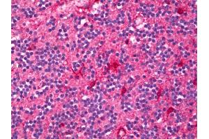 Anti-ENPP2 / Autotaxin antibody IHC of human brain, cerebellum. (ENPP2 抗体)