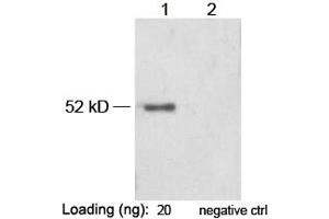 Lane 1: VSV-G-tag fusion protein in Hela cell lysate (~ 52 kD) Lane 2: Negative Hela cell lysateAntibody: 1 µg/mL Rabbit Anti-VSV-G-tag [HRP] Polyclonal Antibody (ABIN398532) The signal was developed with LumiSensorTM HRP Substrate Kit (ABIN769939) (VSV-g Tag 抗体  (HRP))