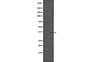 Western blot analysis of CPXCR1 expression in Fetal brain lysate (Human) ;,The lane on the left is treated with the antigen-specific peptide. (CPXCR1 抗体)