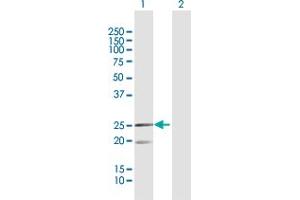 Western Blot analysis of MRPL12 expression in transfected 293T cell line by MRPL12 MaxPab polyclonal antibody. (MRPL12 抗体  (AA 1-198))
